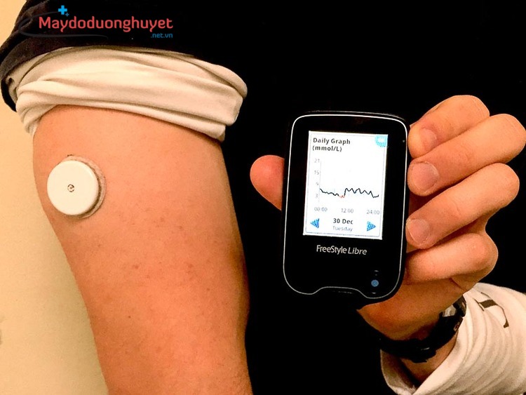 Hệ thống FreeStyle Libre cung cấp kết quả đo đường huyết theo thời gian thực mỗi phút